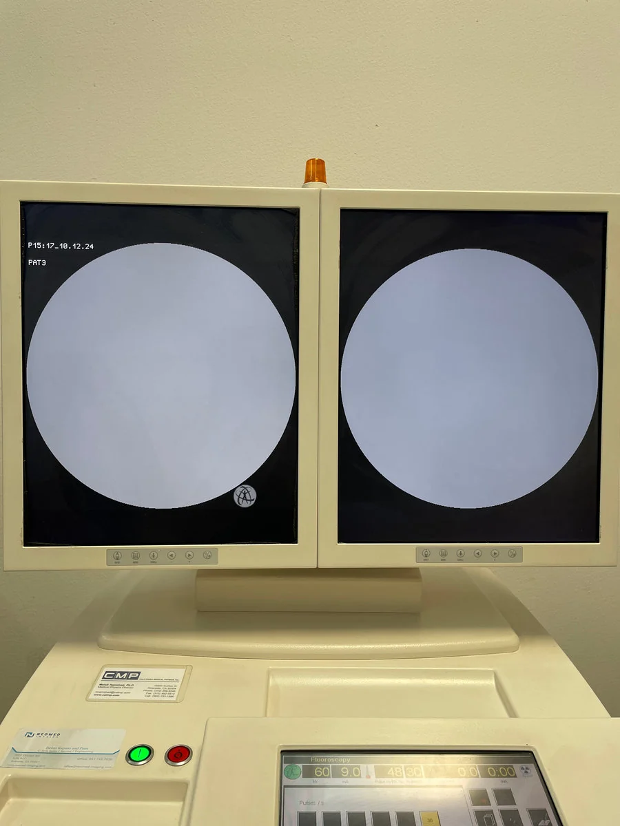 Budget C-Arm Ziehm Vision (V1): SN 9064 — photograph 4
