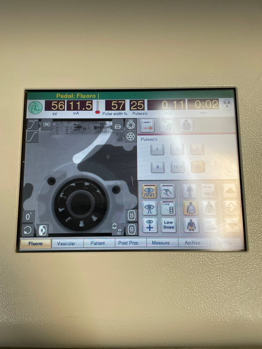 C-Arm Ziehm Vision RFD: SN 20086 — photograph 3